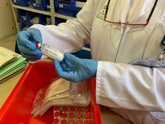 Foto: Cuatro fármacos contra la hepatitis C multiplican el efecto del remdesivir contra la COVID-19