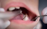 Foto: Aumentan los casos de bruxismo, caries y periodontitis por el estrés de la Covid-19