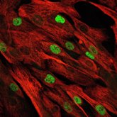 Foto: Un estudio abre la puerta a la primera terapia celular contra trastornos musculares genéticos