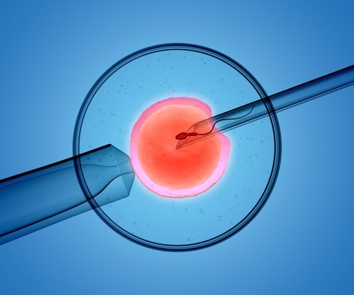 Archivo - 3D rendering of the icsi(intracytoplasmic sperm injection) process - in which a single sperm is injected directly into an egg