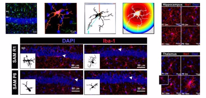 Diversas imágenes de células microgliales y de regiones cerebrales obtenidas en el último estudio publicado por la Unidad de Neuroinflamación del ISCIII.