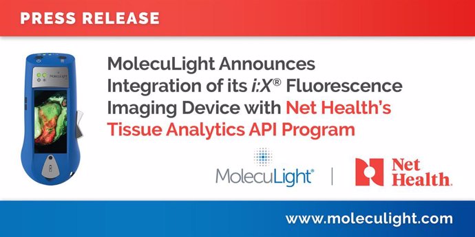 MolecuLight Announces Integration of its i:X Fluorescence Imaging Device with Net Healths Tissue Analytics API Program