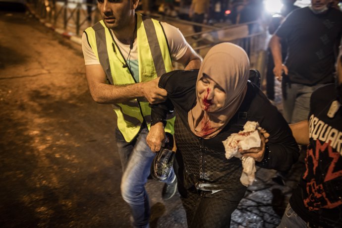Una mujer herida durante los enfrentamientos entre manfiestantes y fuerzas de seguridad de Israel en Jerusalén