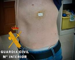 Joven herido tras ser agredido con un destornillador en Cuevas del Almanzora (Almería)