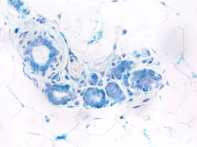 Archivo - Descubren una conexión entre senescencia y células madre provocada por una proteína iniciadora del cáncer de mama