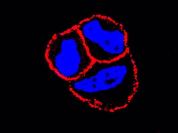 Archivo - El CSIC evidencia que el uso combinado de un nuevo fármaco mejora la eficiencia de algunas terapias de cáncer de mama