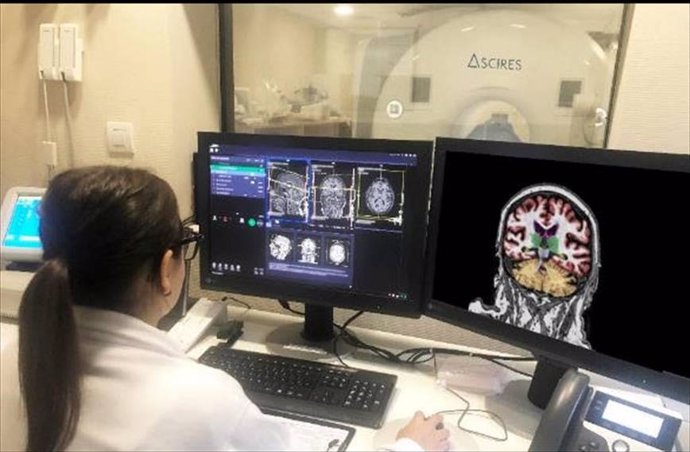 Archivo - La plataforma calcula volúmenes y realiza tractografías cerebrales, para diagnosticar enfermedades como el Alzheimer, la demencia, la epilepsia o la esclerosis múltiple.