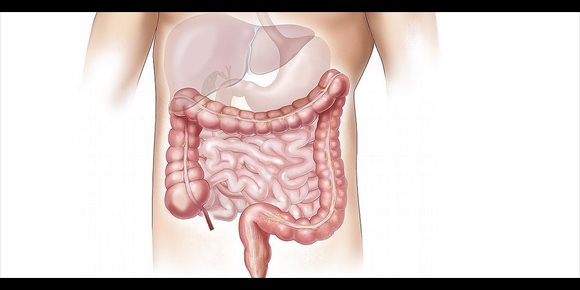 10. Los síntomas de los pacientes con síndrome del intestino irritable mejoraron durante el confinamiento