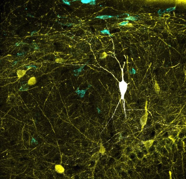 Neurona inhibidora del hipocampo registrada y teñida in vivo (en blanco). En amarillo y azul se muestran los cuerpos celulares y las ramificaciones de otras neuronas inhibidoras.
