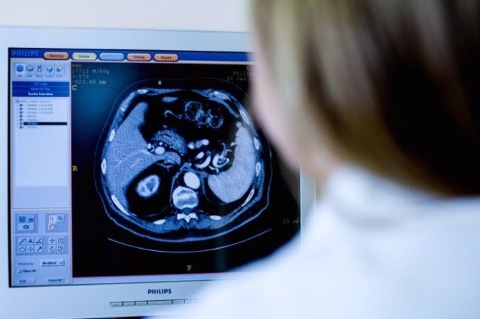 Archivo - El Hospital Vithas Medimar incorpora una técnica capaz de detectar un indicativo de recaída en pacientes tratados de cáncer de próstata