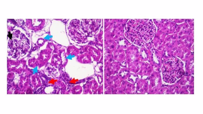 Imágenes microscópicas que muestran el aspecto anormal del riñón (con daños renales) en las ratas obesas y diabéticas sin tratamiento con melatonina (panel izquierdo) y en la de derecha muestran mejora del daño renal de las tratas con melatonina.