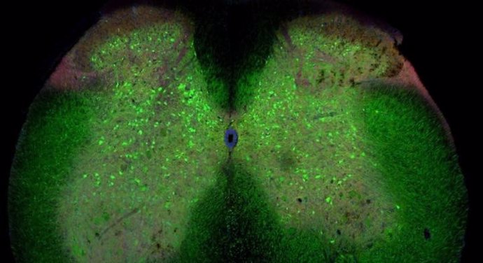 La médula espinal de un ratón con ELA. Las células verdes son interneuronas inhibidoras.