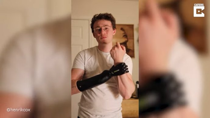 Este joven de 25 años enseña las aventuras y desventuras con su mano biónica
