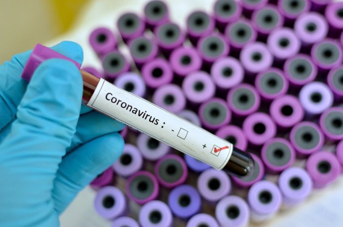 Archivo - Coronavirus positive  Blood sample with respiratory coronavirus positive