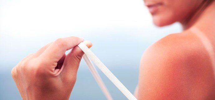 Cáncer de piel: la pandemia que podemos evitar.