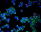 Foto: La 'grasa mala' impide que las células T ataquen al cáncer