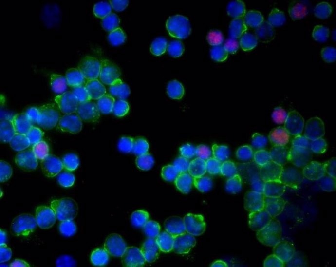 Archivo - Células T que expresan Foxp3 (rosa)
