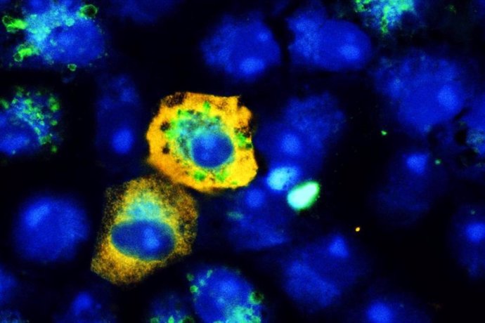 Cuando el SARS-CoV-2 (amarillo) infecta las células de riñón de mono, reduce el mecanismo de reciclaje celular, lo que significa que hay menos señales de autofagia (verde) que en las células no infectadas. La tinción azul representa los núcleos.