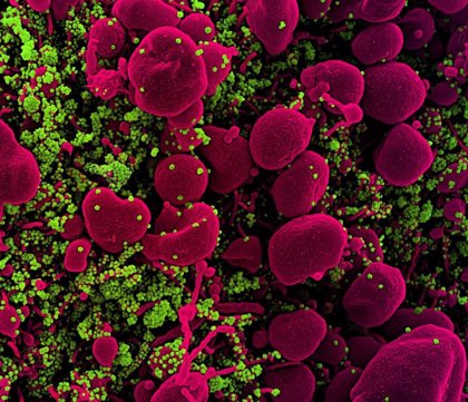 Un modelo informático apunta que el coronavirus está más adaptado a  infectar células humanas que animales