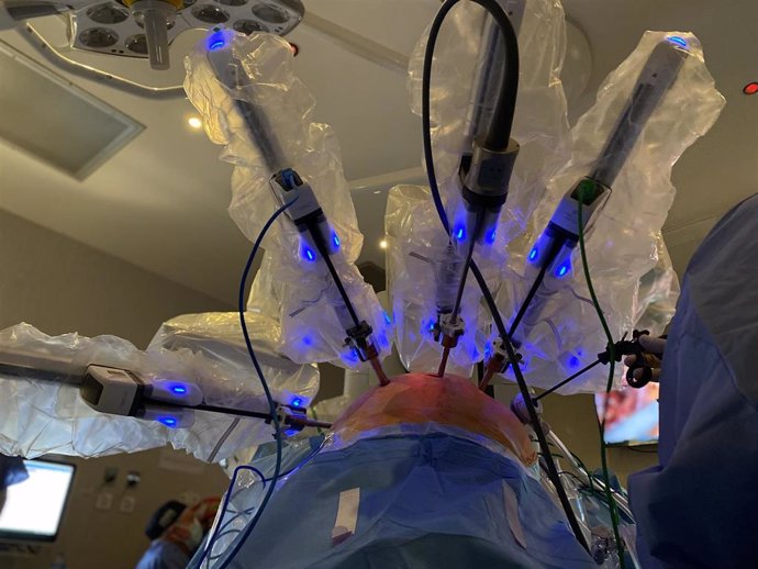 Detalle de los brazos del nuevo robot quirúrgico del Sistema Da Vinci incorporado al Hospital Reina Sofía de Córdoba.