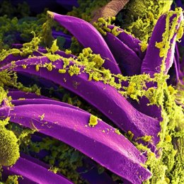 Archivo - Bacteria de la peste, Yersinia pestis