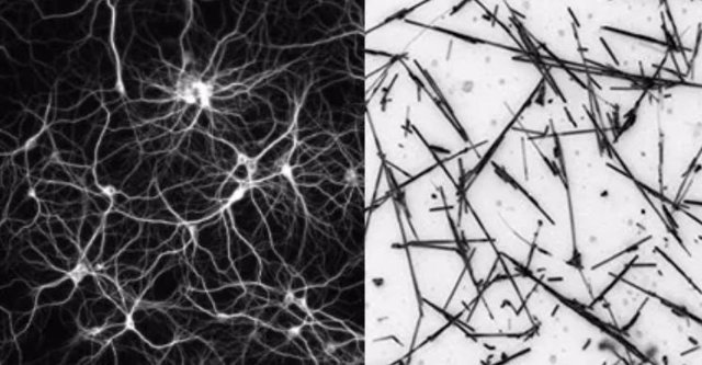 Imagen conceptual de una red neuronal (izquierda) junto a una imagen de micrografía óptica de una red de nanocables.