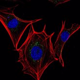 Foto: La interacción entre dos proteínas celulares, posible diana frente al cáncer