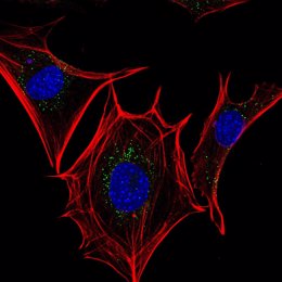 Fibroblastos embrionarios de ratón modificado. El citoesqueleto aparece en rojo y en azul el núcleo de la célula.