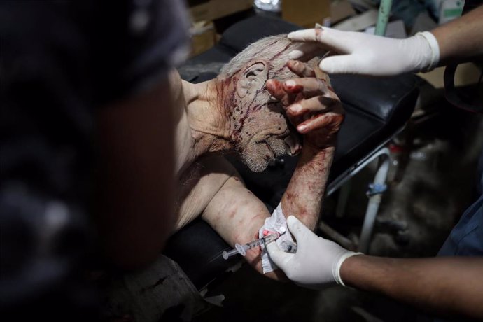 Hombre herido en Idlib 