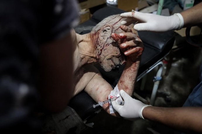 FILED - 21 June 2021, Syria, Al-Bara: Medics treat a wounded Syrian man following a reported shelling by the Syrian government on Al-Bara city, in the Jabal al-Zawiya region of the rebel-held Idlib province. Photo: Anas Alkharboutli/dpa