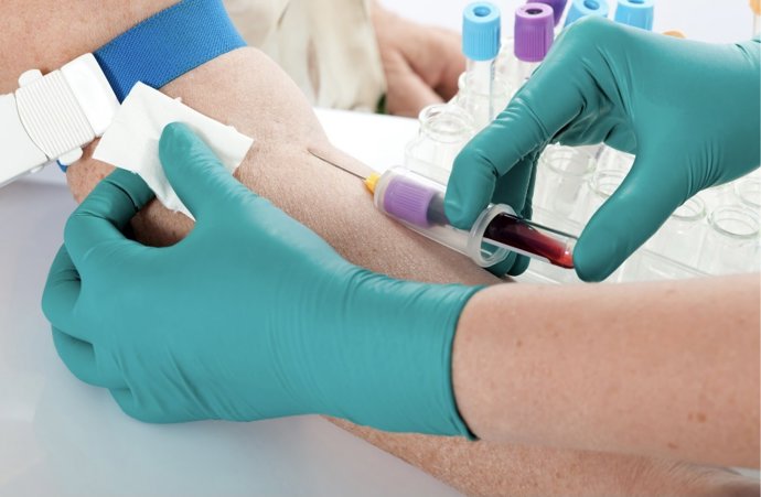 Archivo - Prueba que permite detectar anticuerpos frente al coronavirus