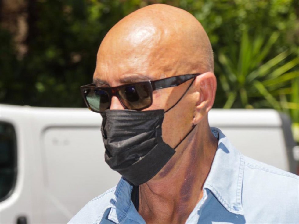 Kiko Matamoros con el rostro amoratado