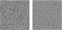 Las células de cáncer de mama triple negativas se muestran a la izquierda. Sin la proteína de unión al ARN YTHDF2 (derecha), sobrevivieron menos células cancerosas.