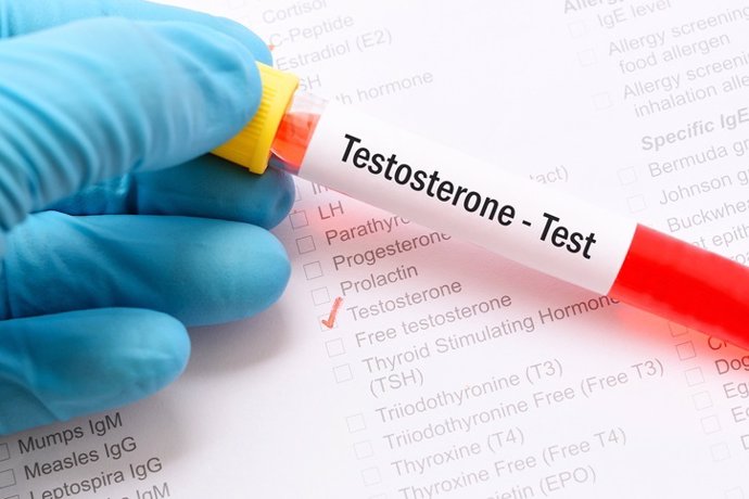 Archivo - Testosterona test