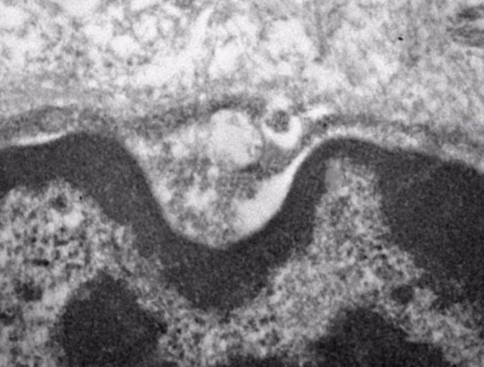 Imagen de microscopio electrónico que muestra el nuevo coronavirus dentro de las glándulas salivales