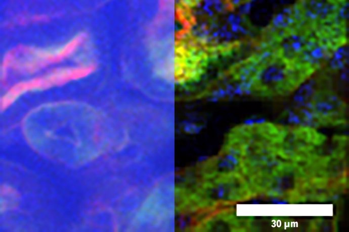 Archivo - Imagen de microscopía de enfoque temporal (TFM), a la izquierda, e imagen de DEEP-TFM, a la derecha, de un riñón captado a través de un medio de dispersión