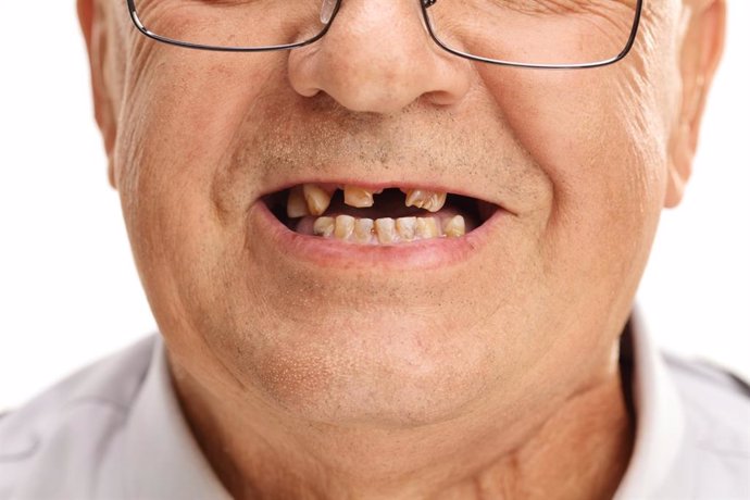 Archivo - Hombre sin dientes.