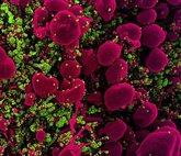 Foto: Un análisis de sangre permite seguir la evolución de la infección por coronavirus