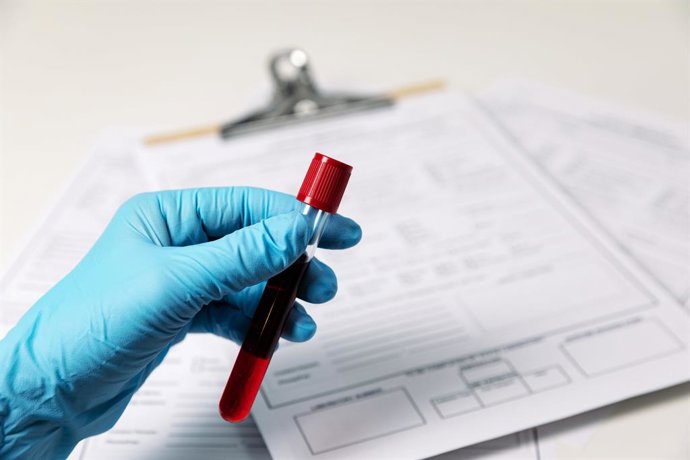 Trublood is an non-invasive liquid biopsy for diagnosis of prostate cancer