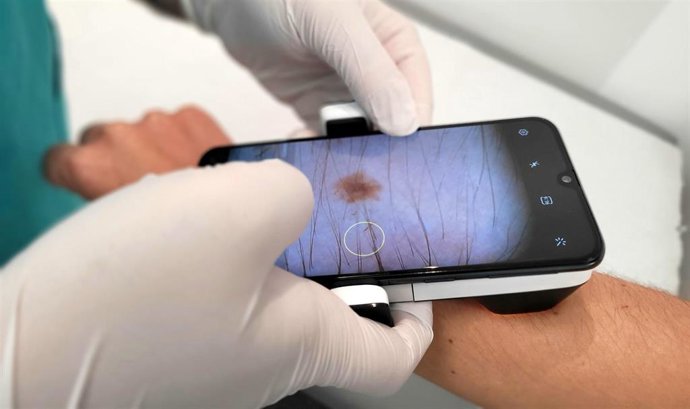 Servicio de Teledermatología de Quirónsalud.