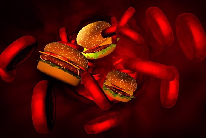 Archivo - Colesterol, arterias con hamburguesas.