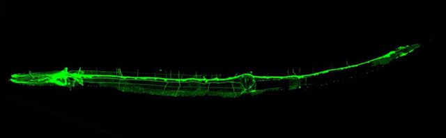 Fotografía de un animal C. Elegans transgénico que expresa la proteína de fluorescencia GFP en el sistema nervioso.