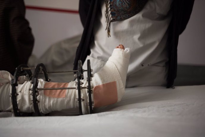 Archivo - Un niño herido a causa de la explosión de una bomba en Afganistán