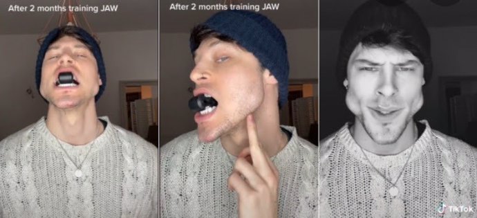 Influencer muestra los resultados tras usar un ejercitador de mandíbula