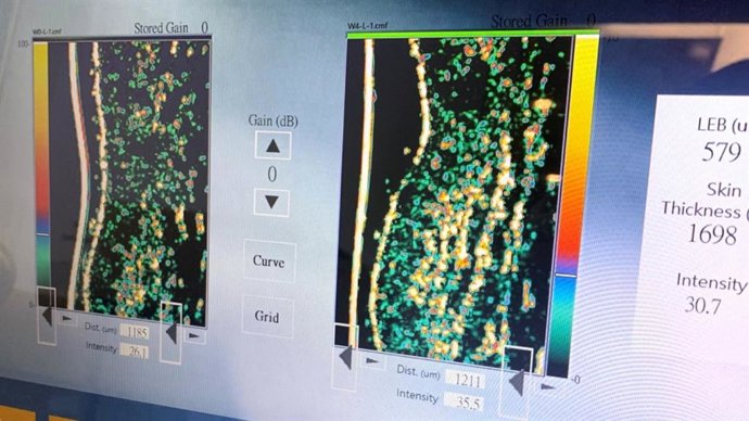 Taiwans medical device company challenges the limit of science, launching the most expensive collagen in the contemporary market.