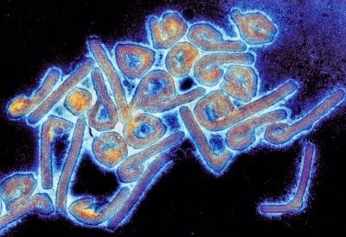 Detectado en Guinea el primer caso de enfermedad por el virus de Marburgo  en África Occidental