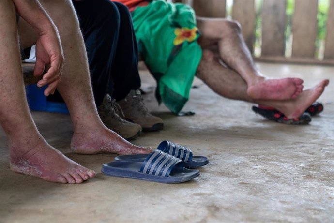 Archivo - Migrantes atendidos por MSF en Panamá tras cruzar el tapón del Darién