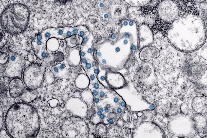 Archivo - Arxivo - Partícules del virus SARS-CoV-2, acolorides en blau, en una imatge de microscopi d'electrons. /