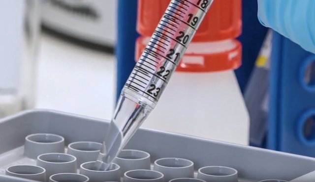 Nuevo método para la detección de SARS-COV-2 desarrollado por la UBU.