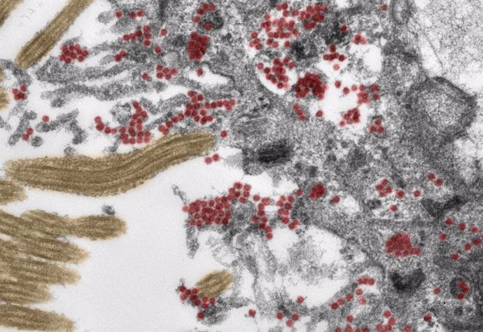 Archivo - Imagen de microscopio electrónico (oloreada artificialmente) que muestra una sección de una célula ciliada en la mucosa olfativa. Partículas intactas del SARS-CoV-2 (rojo) se encuentran tanto en el interior de la célula como en los procesos ce